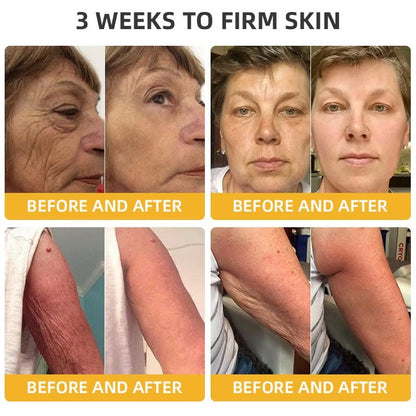 Alcuras™ BeeLift Anti-Aging Firming Cream,Address Crepe & Sagging(🔥49% Off for a Limited Time!)